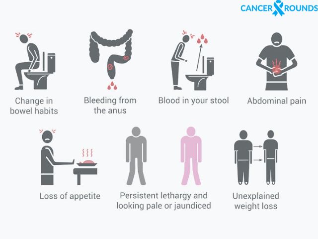 symptoms of colon cancer
