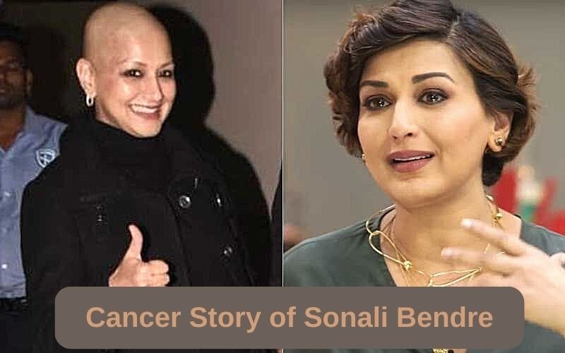 Cancer Recovery Story of Sonali Bendre
