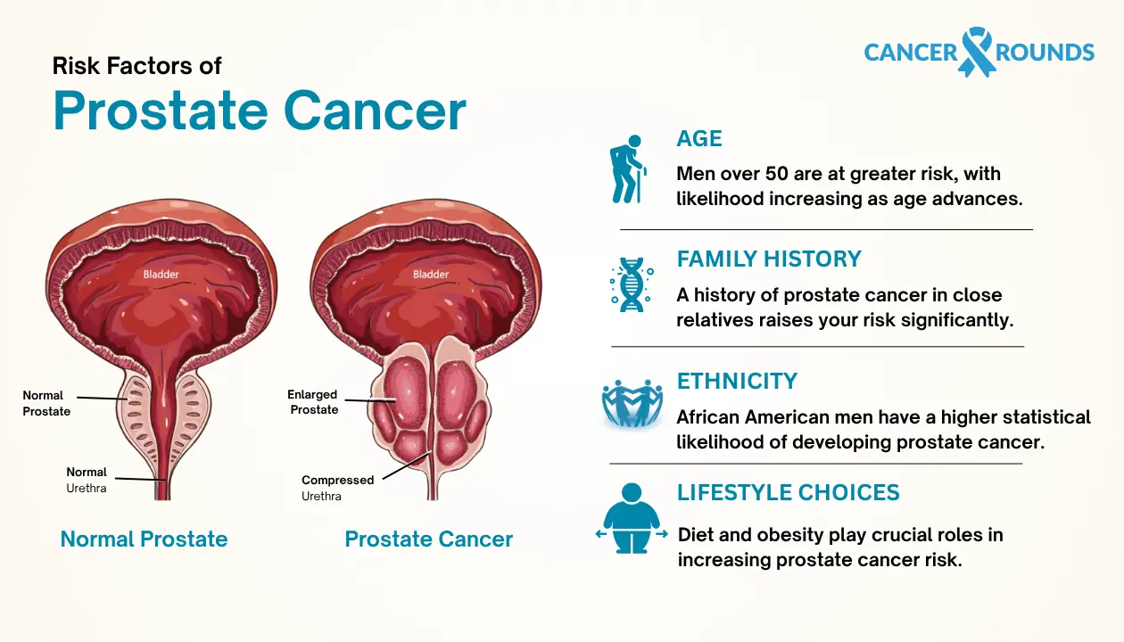 Risk factors of prostate cancer