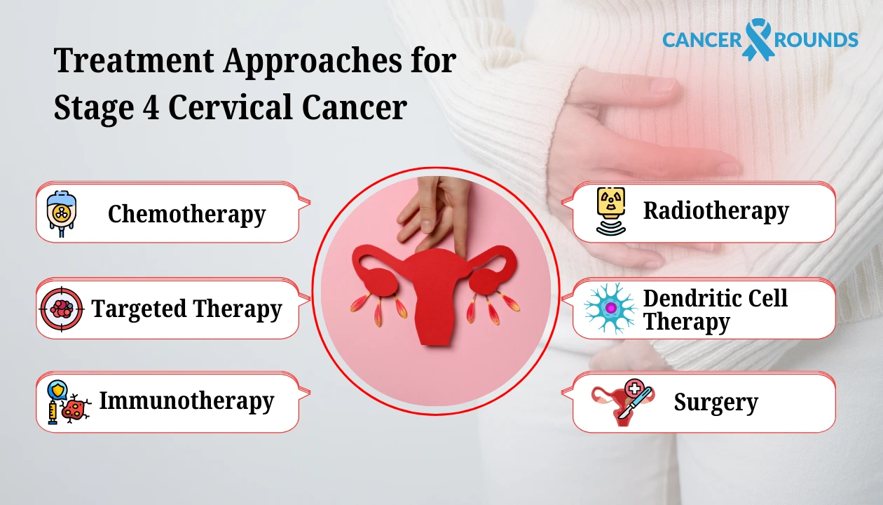 Treatment approaches for stage 4 cervical cancer