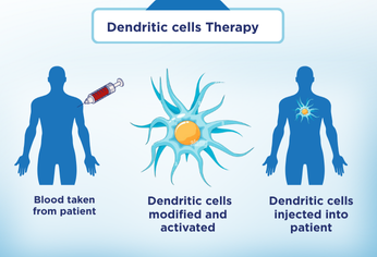 Understanding Dendritic Cell Therapy: A New Hope for Cancer Treatment