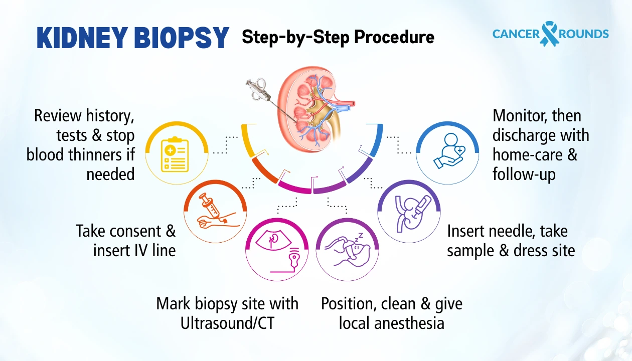 Kidney biopsy procedure