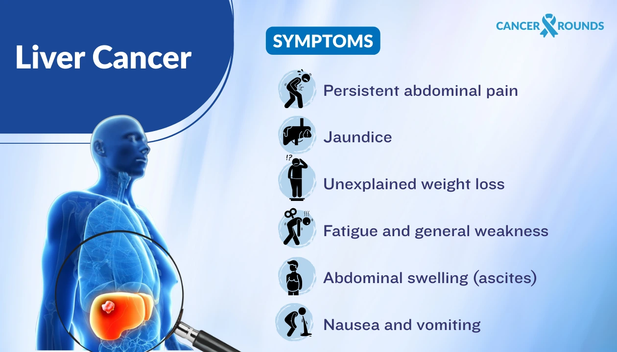symptoms of liver cancer