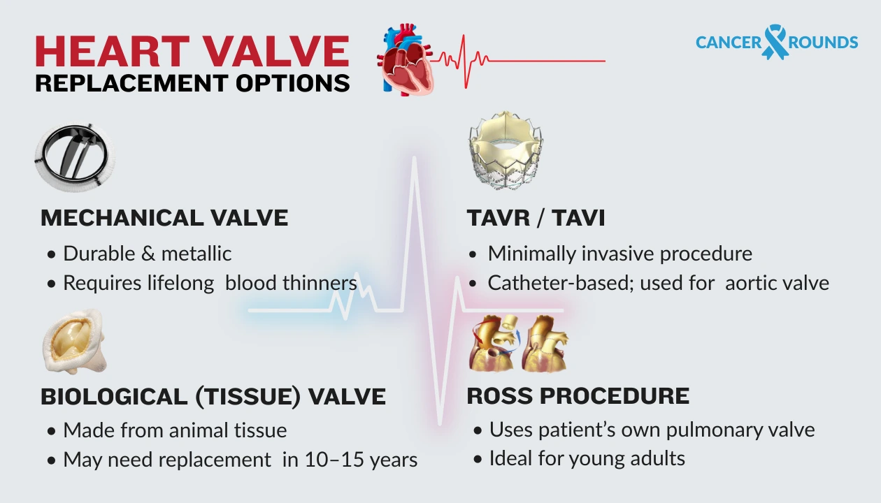 types of heart valve replacement