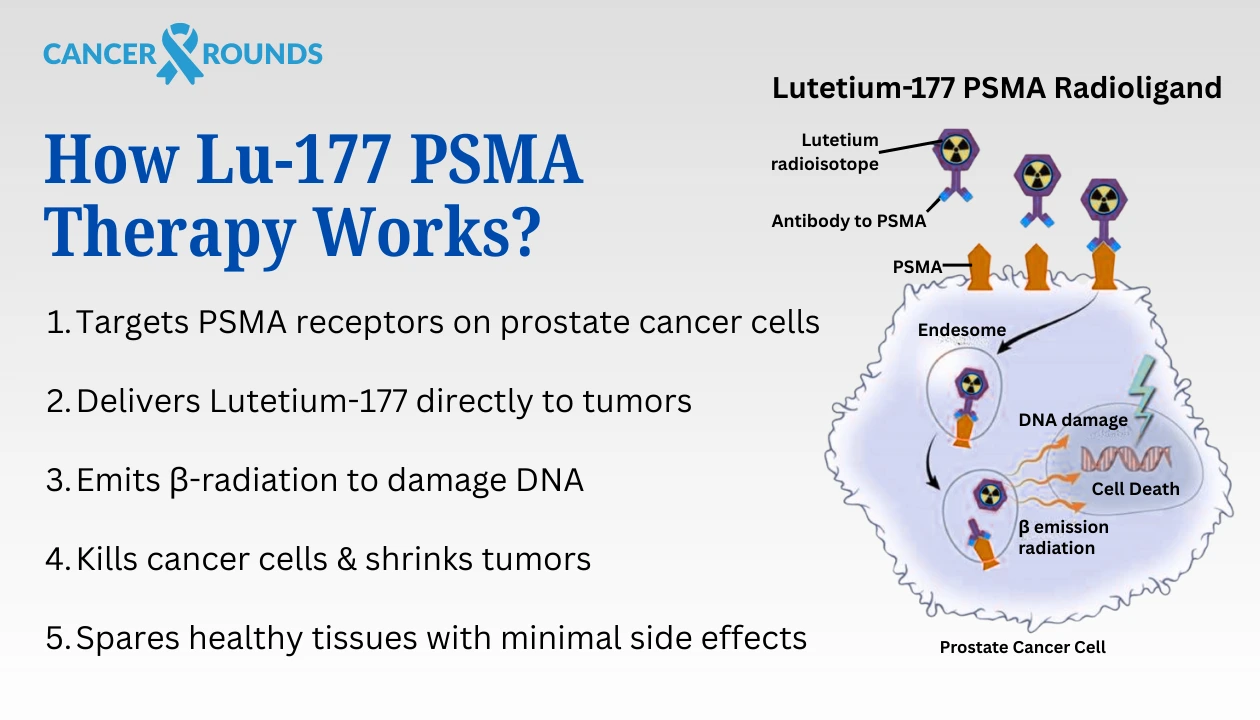 what is Lu-177 PSMA theory