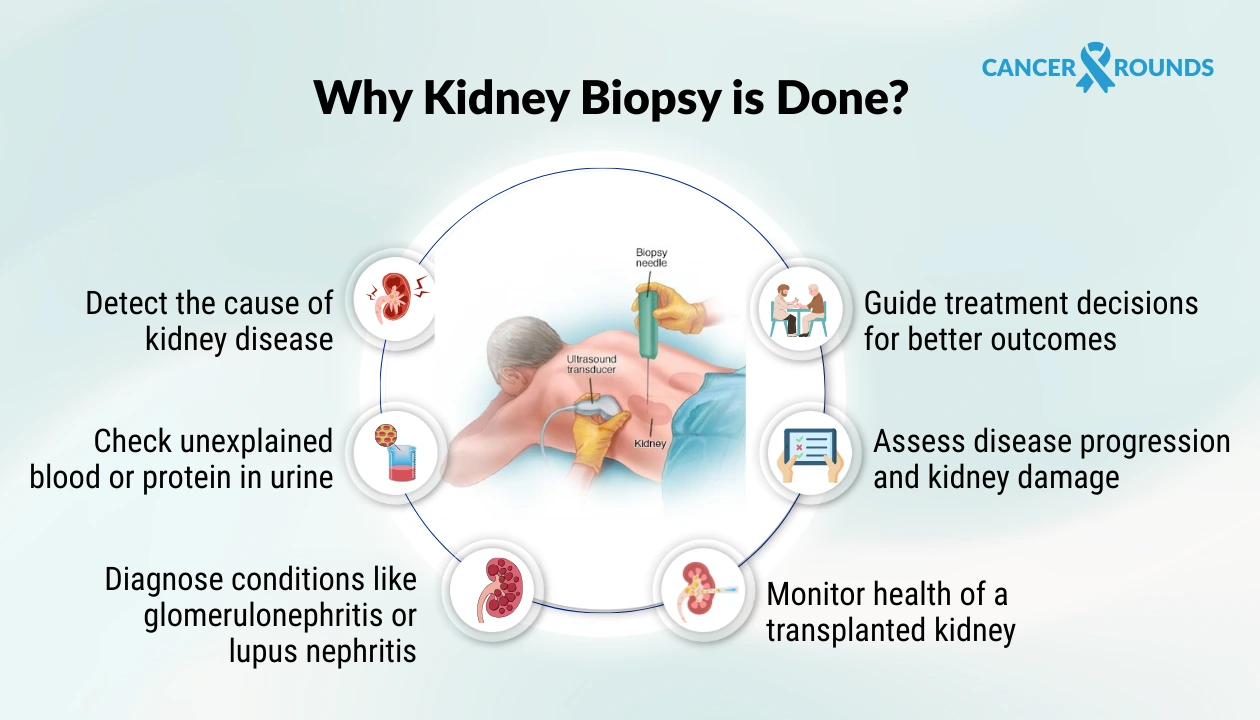why kidney biopsy done