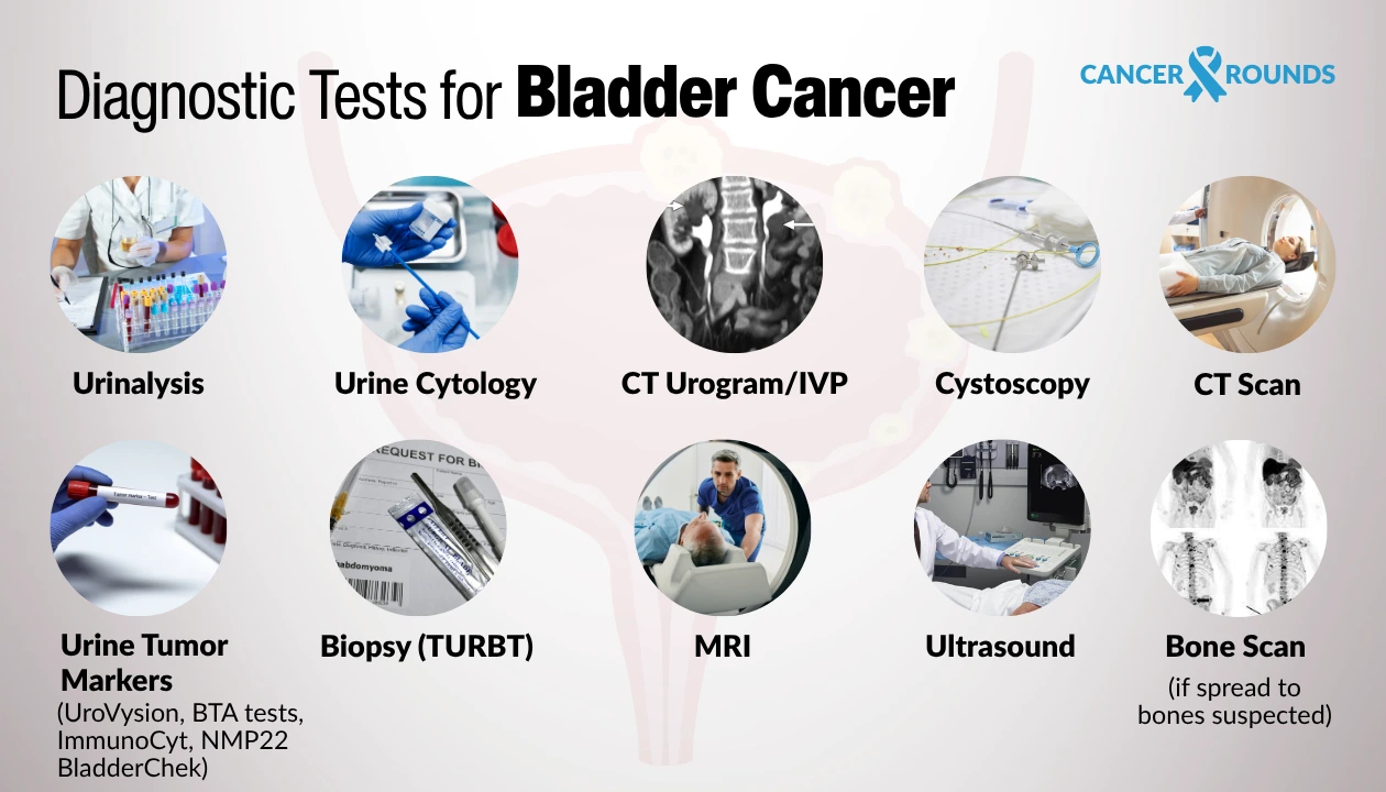 Diagnostic tests for bladder cancer