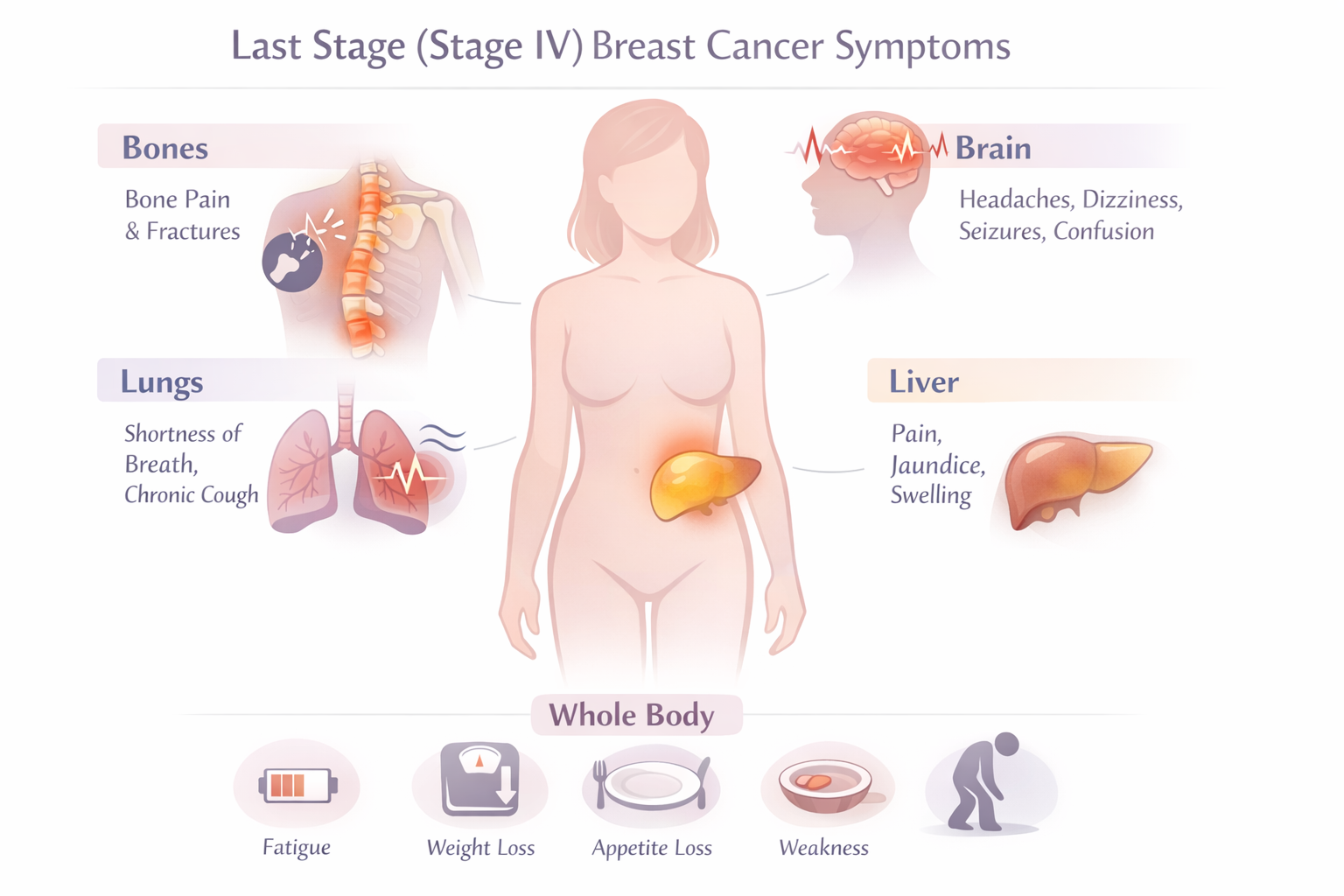Last Stage Breast Cancer Symptoms